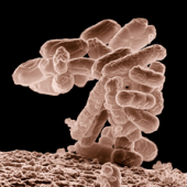 Trasplante de Microbiota fecal